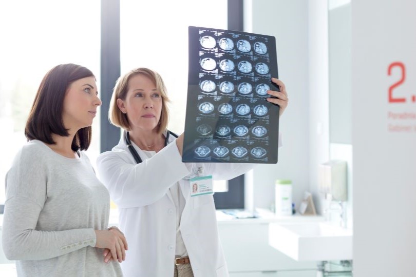 Professional sanitari mostra plaques de ressonància magnètica cerebral a pacient en consulta mèdica amb llum natural i equipament clínic modern.